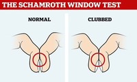  Các tiến bộ trong điều trị ung thư tụy, đường mật 第3张